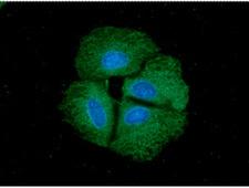 PPID / Cyclophilin D Antibody - ICC/IF analysis of PPID in Hep3B cells. The cell was stained with PPID antibody (1:100).The secondary antibody (green) was used Alexa Fluor 488. DAPI was stained the cell nucleus (blue).