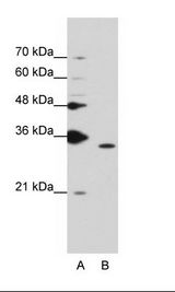 PPIE / Cyclophilin E Antibody - A: Marker, B: K562 Cell Lysate.  This image was taken for the unconjugated form of this product. Other forms have not been tested.