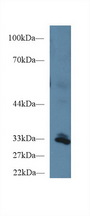 PPIE / Cyclophilin E Antibody - Western Blot; Sample: Human Liver lysate; Primary Ab: 1µg/ml Rabbit Anti-Human PPIE Antibody Second Ab: 0.2µg/mL HRP-Linked Caprine Anti-Rabbit IgG Polyclonal Antibody