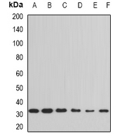 PPIE / Cyclophilin E Antibody - Western blot analysis of Cyclophilin E expression in HeLa (A); THP1 (B); Jurkat (C); HL60 (D); mouse testis (E); mouse thymus (F) whole cell lysates.