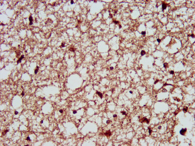 PPIE / Cyclophilin E Antibody - Immunohistochemistry image at a dilution of 1:300 and staining in paraffin-embedded human brain tissue performed on a Leica BondTM system. After dewaxing and hydration, antigen retrieval was mediated by high pressure in a citrate buffer (pH 6.0) . Section was blocked with 10% normal goat serum 30min at RT. Then primary antibody (1% BSA) was incubated at 4 °C overnight. The primary is detected by a biotinylated secondary antibody and visualized using an HRP conjugated SP system.