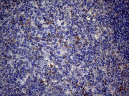 PPIF / Cyclophilin F Antibody - Immunohistochemical staining of paraffin-embedded Human tonsil within the normal limits using anti-PPIF mouse monoclonal antibody. (Heat-induced epitope retrieval by 1mM EDTA in 10mM Tris buffer. (pH8.5) at 120°C for 3 min. (1:150)