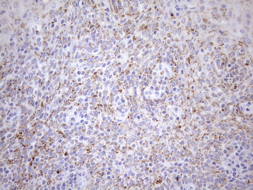 PPIF / Cyclophilin F Antibody - Immunohistochemical staining of paraffin-embedded Human tonsil within the normal limits using anti-PPIF mouse monoclonal antibody. (Heat-induced epitope retrieval by 1mM EDTA in 10mM Tris buffer. (pH8.5) at 120°C for 3 min. (1:150)