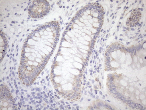 PPIF / Cyclophilin F Antibody - Immunohistochemical staining of paraffin-embedded Human colon tissue within the normal limits using anti-PPIF mouse monoclonal antibody. (Heat-induced epitope retrieval by 1mM EDTA in 10mM Tris buffer. (pH8.5) at 120°C for 3 min. (1:150)