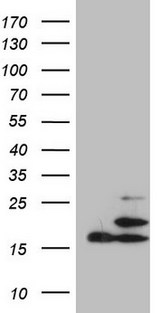 PPIF / Cyclophilin F Antibody - HEK293T cells were transfected with the pCMV6-ENTRY control. (Left lane) or pCMV6-ENTRY PPIF. (Right lane) cDNA for 48 hrs and lysed. Equivalent amounts of cell lysates. (5 ug per lane) were separated by SDS-PAGE and immunoblotted with anti-PPIF. (1:2000)