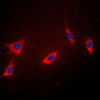 PPIF / Cyclophilin F Antibody - Immunofluorescent analysis of Cyclophilin F staining in K562 cells. Formalin-fixed cells were permeabilized with 0.1% Triton X-100 in TBS for 5-10 minutes and blocked with 3% BSA-PBS for 30 minutes at room temperature. Cells were probed with the primary antibody in 3% BSA-PBS and incubated overnight at 4 C in a humidified chamber. Cells were washed with PBST and incubated with a DyLight 594-conjugated secondary antibody (red) in PBS at room temperature in the dark. DAPI was used to stain the cell nuclei (blue).