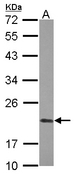 PPIF / Cyclophilin F Antibody - Sample (30 ug of whole cell lysate) A: A431 12% SDS PAGE PPIF / Cyclophilin F antibody diluted at 1:1000