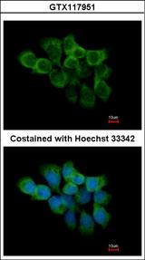 PPIF / Cyclophilin F Antibody - Immunofluorescence of methanol-fixed A431, using PPIF antibody at 1:500 dilution.
