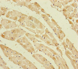 PPIF / Cyclophilin F Antibody - Immunohistochemistry of paraffin-embedded human heart tissue at dilution of 1:100