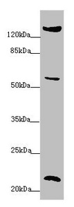 PPIF / Cyclophilin F Antibody - Western blot All Lanes: PPIF antibody at 5.65 ug/ml+ 293T whole cell lysate Secondary Goat polyclonal to rabbit IgG at 1/10000 dilution Predicted band size: 23,17 kDa Observed band size: 22,58,150 kDa