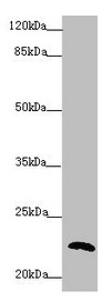 PPIF / Cyclophilin F Antibody - Western blot All lanes: PPIF antibody at 5.65µg/ml + 293T whole cell lysate Secondary Goat polyclonal to rabbit IgG at 1/10000 dilution Predicted band size: 23, 17 kDa Observed band size: 23 kDa