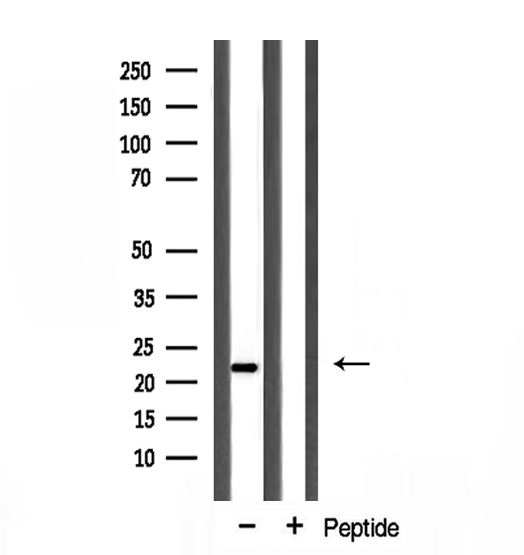PPIF / Cyclophilin F Antibody - Western blot analysis of extracts of mouse brain cells using PPIF antibody.