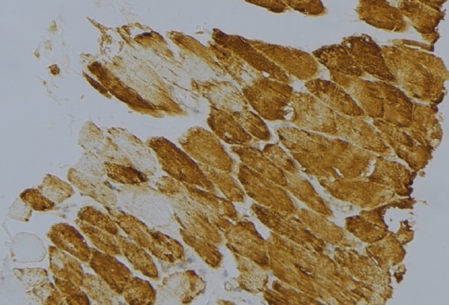 PPIF / Cyclophilin F Antibody - 1:100 staining mouse muscle tissue by IHC-P. The sample was formaldehyde fixed and a heat mediated antigen retrieval step in citrate buffer was performed. The sample was then blocked and incubated with the antibody for 1.5 hours at 22°C. An HRP conjugated goat anti-rabbit antibody was used as the secondary.