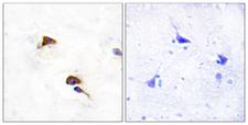 PPIF / Cyclophilin F Antibody - Peptide - + Immunohistochemistry analysis of paraffin-embedded human brain tissue using PPIF antibody.