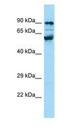PPIG / Cyclophilin G Antibody - PPIG / Cyclophilin G antibody Western Blot of Jurkat.  This image was taken for the unconjugated form of this product. Other forms have not been tested.