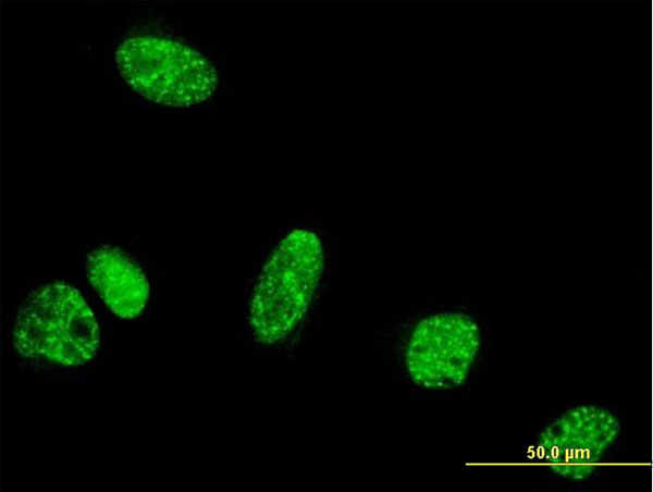 PPIG / Cyclophilin G Antibody - Immunofluorescence of monoclonal antibody to PPIG on HeLa cell. [antibody concentration 10 ug/ml].