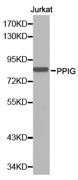 PPIG / Cyclophilin G Antibody - Western blot analysis of extracts of Jurkat cell line, using PPIG antibody.