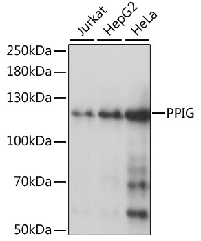 PPIG / Cyclophilin G Antibody - Western blot analysis of extracts of various cell lines, using PPIG antibody at 1:1000 dilution. The secondary antibody used was an HRP Goat Anti-Rabbit IgG (H+L) at 1:10000 dilution. Lysates were loaded 25ug per lane and 3% nonfat dry milk in TBST was used for blocking. An ECL Kit was used for detection and the exposure time was 3s.