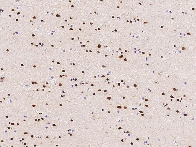 PPIG / Cyclophilin G Antibody - Immunochemical staining of human PPIG in human brain with rabbit polyclonal antibody at 1:500 dilution, formalin-fixed paraffin embedded sections.