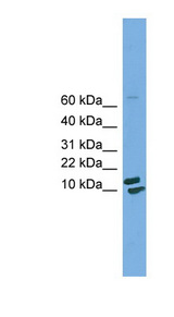 PPIH / Cyclophilin H Antibody - PPIH antibody Western blot of HepG2 cell lysate. This image was taken for the unconjugated form of this product. Other forms have not been tested.