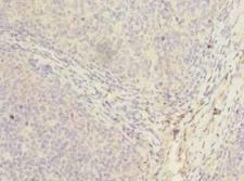 PPIH / Cyclophilin H Antibody - Immunohistochemistry of paraffin-embedded human tonsil tissue using antibody at dilution of 1:100.