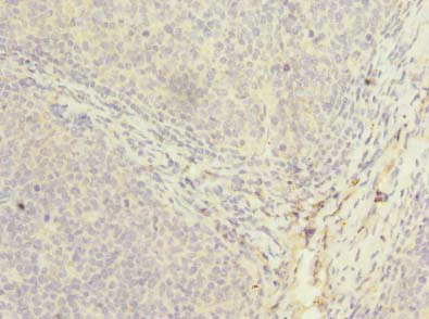 PPIH / Cyclophilin H Antibody - Immunohistochemistry of paraffin-embedded human tonsil tissue using PPIH Antibody at dilution of 1:100