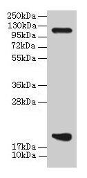 PPIH / Cyclophilin H Antibody - Western blot All lanes: PPIH antibody at 8µg/ml + PC-3 whole cell lysate Secondary Goat polyclonal to rabbit IgG at 1/10000 dilution Predicted band size: 20, 15 kDa Observed band size: 20 kDa