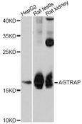 PPIH / Cyclophilin H Antibody - Western blot analysis of extracts of various cell lines, using PPIH antibody at 1:3000 dilution. The secondary antibody used was an HRP Goat Anti-Rabbit IgG (H+L) at 1:10000 dilution. Lysates were loaded 25ug per lane and 3% nonfat dry milk in TBST was used for blocking. An ECL Kit was used for detection and the exposure time was 60s.