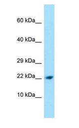 PPIL1 Antibody - PPIL1 antibody Western Blot of A549.  This image was taken for the unconjugated form of this product. Other forms have not been tested.