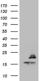 PPIL1 Antibody - HEK293T cells were transfected with the pCMV6-ENTRY control (Left lane) or pCMV6-ENTRY PPIL1 (Right lane) cDNA for 48 hrs and lysed. Equivalent amounts of cell lysates (5 ug per lane) were separated by SDS-PAGE and immunoblotted with anti-PPIL1.