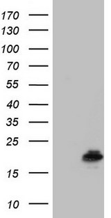 PPIL1 Antibody - HEK293T cells were transfected with the pCMV6-ENTRY control (Left lane) or pCMV6-ENTRY PPIL1 (Right lane) cDNA for 48 hrs and lysed. Equivalent amounts of cell lysates (5 ug per lane) were separated by SDS-PAGE and immunoblotted with anti-PPIL1.