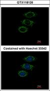 PPIL1 Antibody - Immunofluorescence of paraformaldehyde-fixed MCF-7, using PPIL1 antibody at 1:500 dilution.