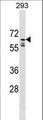 PPIL2 / CYP60 Antibody - PPIL2 Antibody western blot of 293 cell line lysates (35 ug/lane). The PPIL2 antibody detected the PPIL2 protein (arrow).