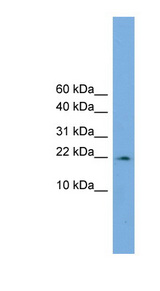 PPIL3 Antibody - PPIL3 antibody Western blot of COLO205 cell lysate. This image was taken for the unconjugated form of this product. Other forms have not been tested.