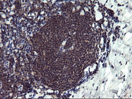PPIL3 Antibody - IHC of paraffin-embedded Human tonsil using anti-PPIL3 mouse monoclonal antibody.