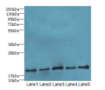 PPIL3 Antibody - Western blot. All lanes: PPIL3 antibody at 10 ug/ml. Lane 1: U87 whole cell lysate. Lane 2: HL60 whole cell lysate. Lane 3: K562 whole cell lysate. Lane 4: Thp-1 whole cell lysate. Lane 5: A549 whole cell lysate. Secondary Goat polyclonal to Rabbit IgG at 1:10000 dilution. Predicted band size: 18 kDa. Observed band size: 18 kDa.
