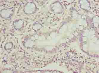 PPIL3 Antibody - Immunohistochemistry of paraffin-embedded human small intestine tissue using antibody at dilution of 1:100.