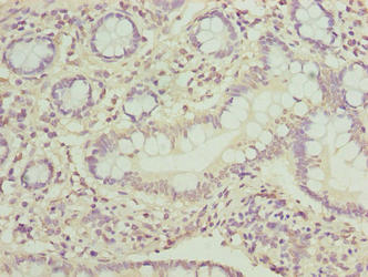 PPIL3 Antibody - Immunohistochemistry of paraffin-embedded human small intestine tissue using PPIL3 Antibody at dilution of 1:100