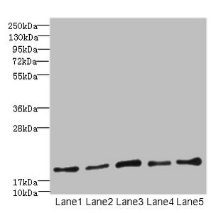 PPIL3 Antibody - Western blot All lanes: PPIL3 antibody at 10µg/ml Lane 1: U87 whole cell lysate Lane 2: HL60 whole cell lysate Lane 3: K562 whole cell lysate Lane 4: THP-1 whole cell lysate Lane 5: A549 whole cell lysate Secondary Goat polyclonal to rabbit IgG at 1/10000 dilution Predicted band size: 19 kDa Observed band size: 19 kDa