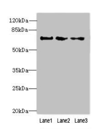 PPIL4 Antibody - Western blot All lanes: PPIL4 antibody at 4µg/ml Lane 1: Hela whole cell lysate Lane 2: Mouse kidney tissue Lane 3: HepG2 whole cell lysate Secondary Goat polyclonal to rabbit IgG at 1/10000 dilution Predicted band size: 58 kDa Observed band size: 70 kDa