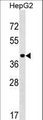 PPIL5 Antibody - PPIL5 Antibody western blot of HepG2 cell line lysates (35 ug/lane). The PPIL5 antibody detected the PPIL5 protein (arrow).