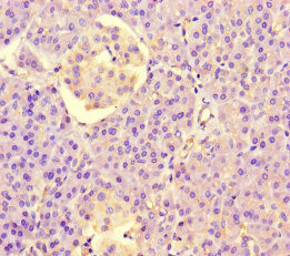 PPIL5 Antibody - Immunohistochemistry of paraffin-embedded human pancreatic tissue at dilution of 1:100