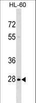 PPIL6 Antibody - PPIL6 Antibody western blot of HL-60 cell line lysates (35 ug/lane). The PPIL6 antibody detected the PPIL6 protein (arrow).