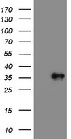 PPIL6 Antibody - HEK293T cells were transfected with the pCMV6-ENTRY control (Left lane) or pCMV6-ENTRY PPIL6 (Right lane) cDNA for 48 hrs and lysed. Equivalent amounts of cell lysates (5 ug per lane) were separated by SDS-PAGE and immunoblotted with anti-PPIL6.