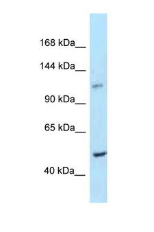 PPIP5K2 / HISPPD1 Antibody - PPIP5K2 / HISPPD1 antibody Western blot of Mouse Thymus lysate. Antibody concentration 1 ug/ml.  This image was taken for the unconjugated form of this product. Other forms have not been tested.