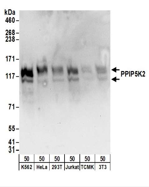 PPIP5K2 / HISPPD1 Antibody - Detection of Human and Mouse PPIP5K2 by Western Blot. Samples: Whole cell lysate (50 ug) from K562, HeLa, 293T, Jurkat, mouse TCMK-1, and mouse NIH3T3 cells. Antibodies: Affinity purified rabbit anti-PPIP5K2 antibody used for WB at 0.4 ug/ml. Detection: Chemiluminescence with an exposure time of 10 seconds.