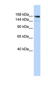 PPL / Periplakin Antibody - PPL / Periplakin antibody Western blot of MCF7 cell lysate. This image was taken for the unconjugated form of this product. Other forms have not been tested.