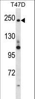 PPL / Periplakin Antibody - PPL Antibody western blot of T47D cell line lysates (35 ug/lane). The PPL antibody detected the PPL protein (arrow).