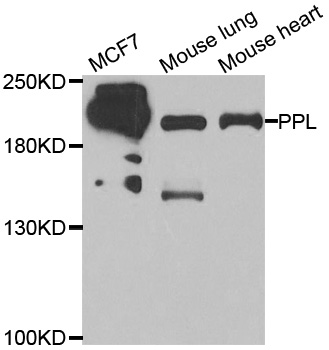 PPL / Periplakin Antibody - Western blot analysis of extracts of various cell lines.