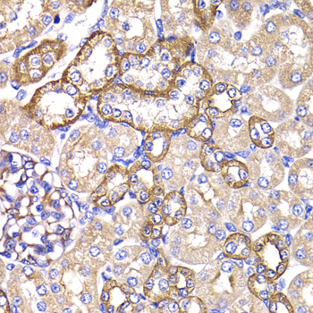 PPL / Periplakin Antibody - Immunohistochemistry of paraffin-embedded rat kidney tissue.